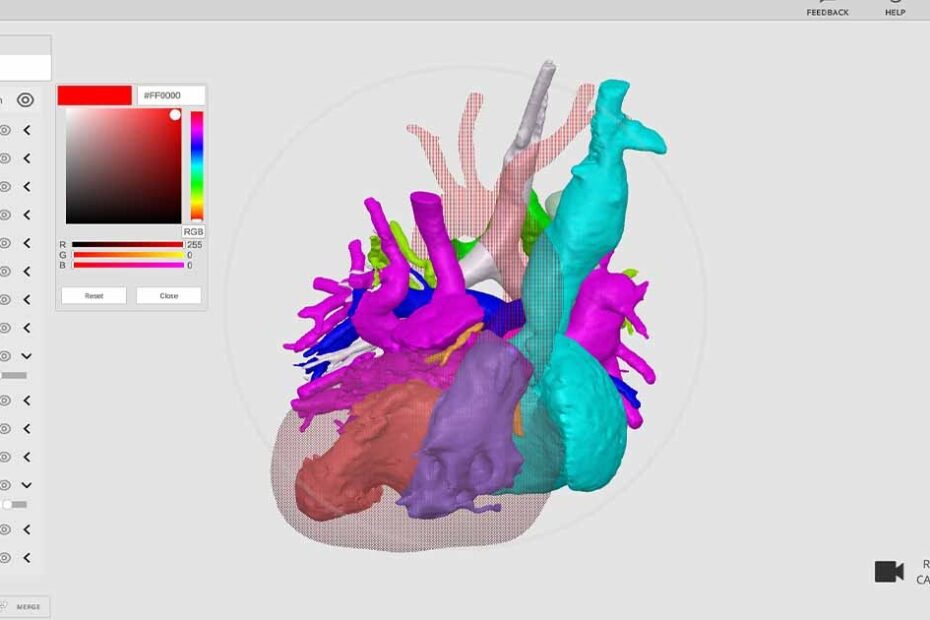 Rady Children’s debuts free 3D image viewing software, available for other providers