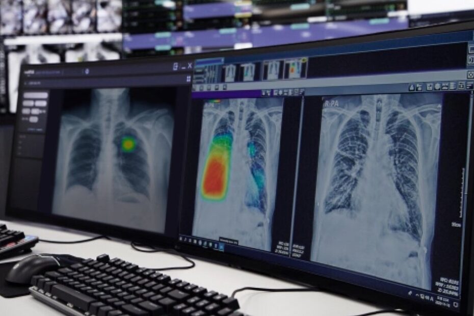 National Healthcare Group adopts AI for lung, heart disease screening